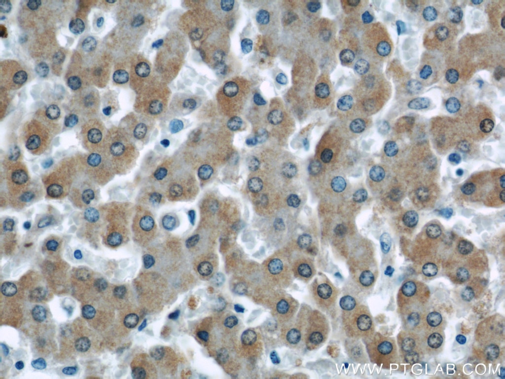 Immunohistochemistry (IHC) staining of human liver tissue using UCP2 Polyclonal antibody (11081-1-AP)