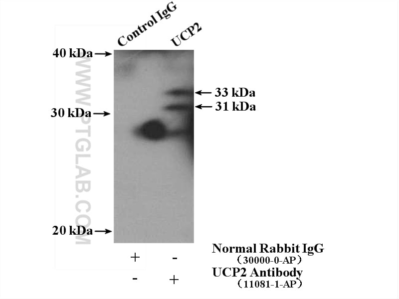 Immunoprecipitation (IP) experiment of mouse skeletal muscle tissue using UCP2 Polyclonal antibody (11081-1-AP)