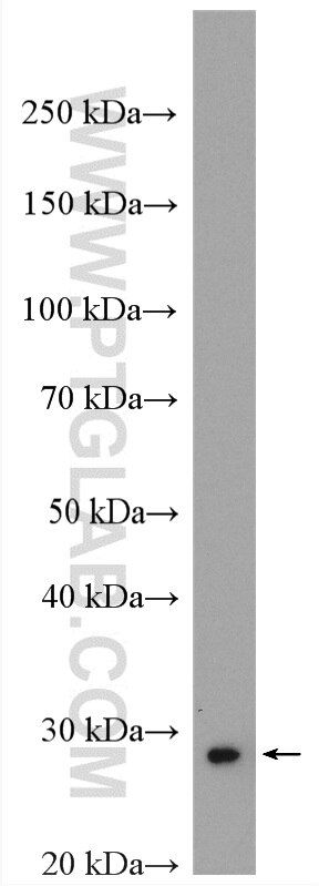 Western Blot (WB) analysis of mouse heart tissue using UCP2 Polyclonal antibody (11081-1-AP)