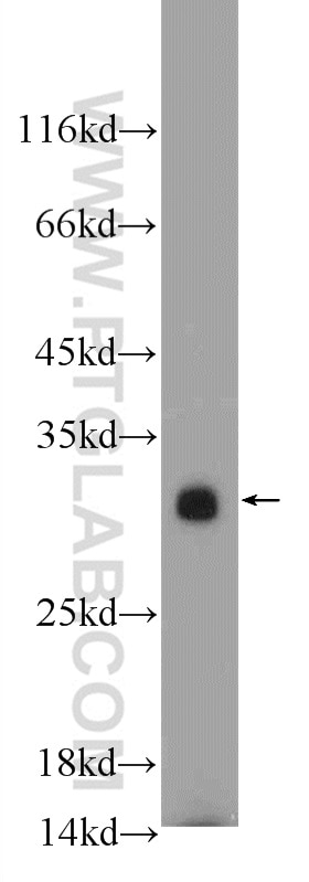 Western Blot (WB) analysis of mouse spleen tissue using UCP2 Polyclonal antibody (11081-1-AP)