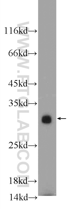 WB analysis of mouse spleen using 11081-1-AP