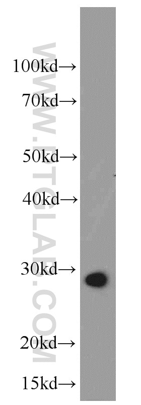Western Blot (WB) analysis of mouse skeletal muscle tissue using UCP2 Polyclonal antibody (11081-1-AP)