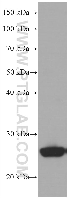 Western Blot (WB) analysis of human adipose tissue using UCP2 Monoclonal antibody (66700-1-Ig)