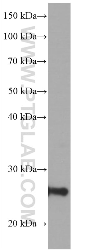 Western Blot (WB) analysis of human skeletal muscle tissue using UCP2 Monoclonal antibody (66700-1-Ig)