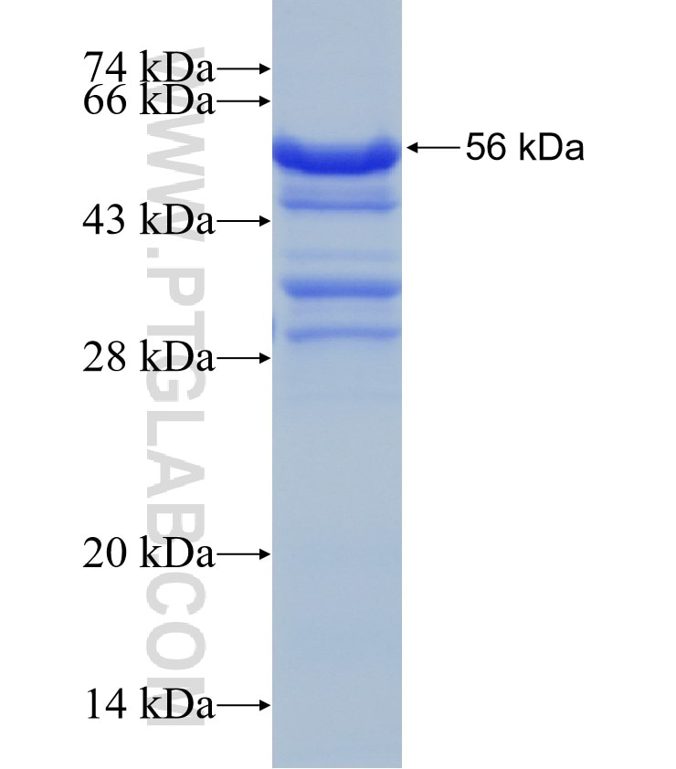 UCP2 fusion protein Ag1551 SDS-PAGE