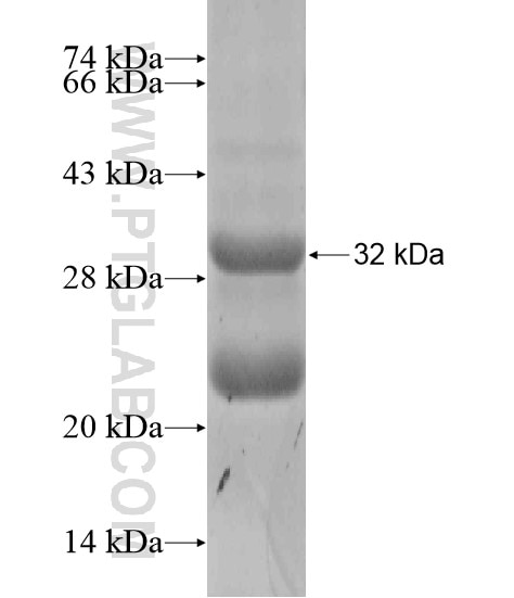 UCP2 fusion protein Ag19361 SDS-PAGE