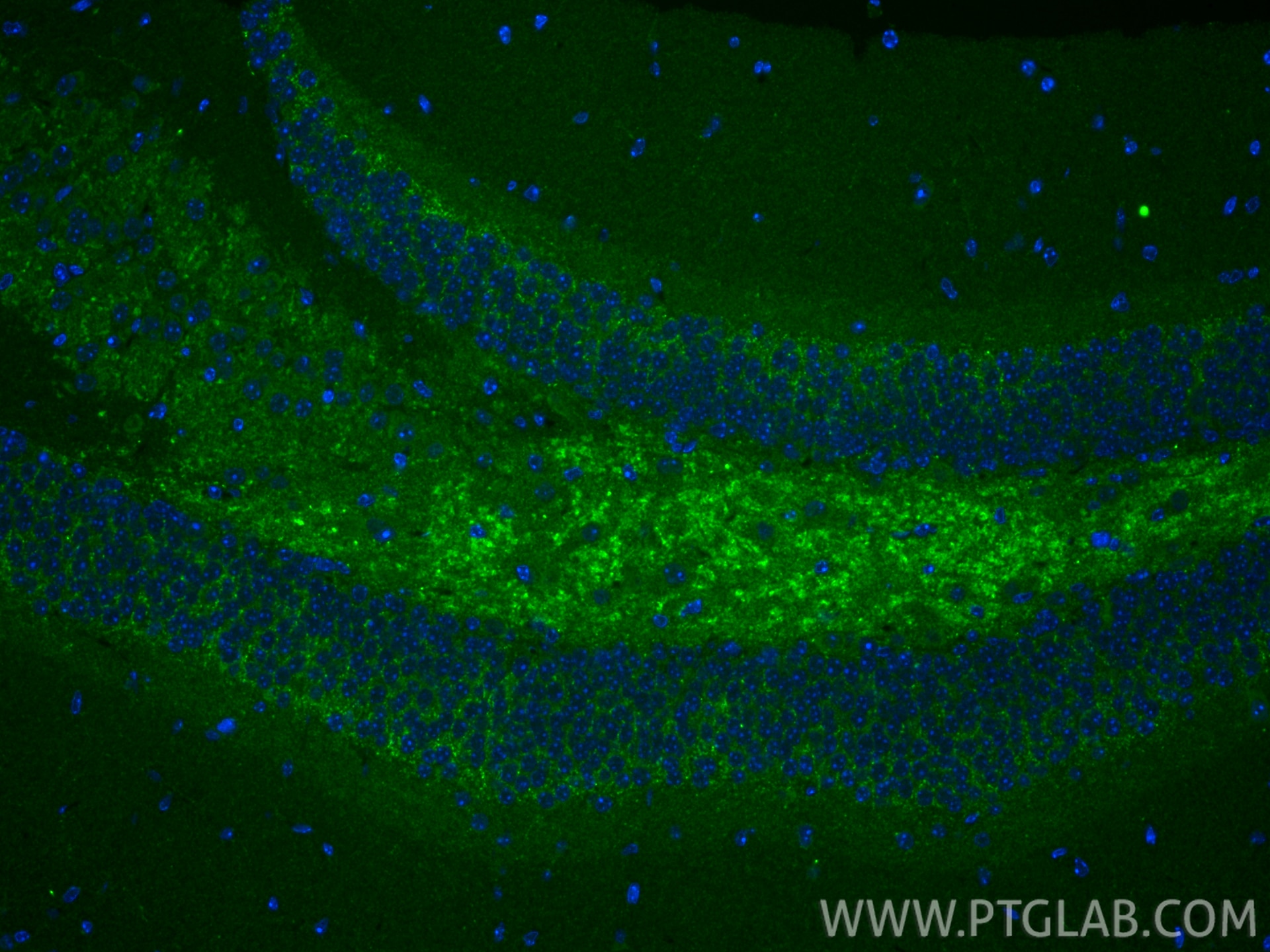 IF Staining of mouse brain using 10750-1-AP Immunofluorescence (IF) / fluorescent staining of mouse brain tissue using UCP3 Polyclonal antibody (10750-1-AP)