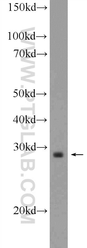 UCP3 Polyclonal antibody