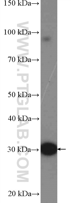 Western Blot (WB) analysis of mouse skeletal muscle tissue using UCP3 Polyclonal antibody (10750-1-AP)