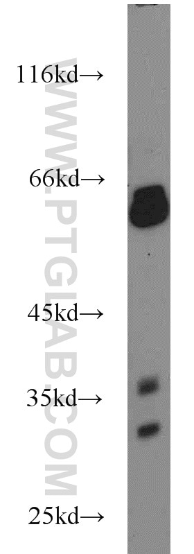 Western Blot (WB) analysis of SGC-7901 cells using UCP3 Polyclonal antibody (10750-1-AP)