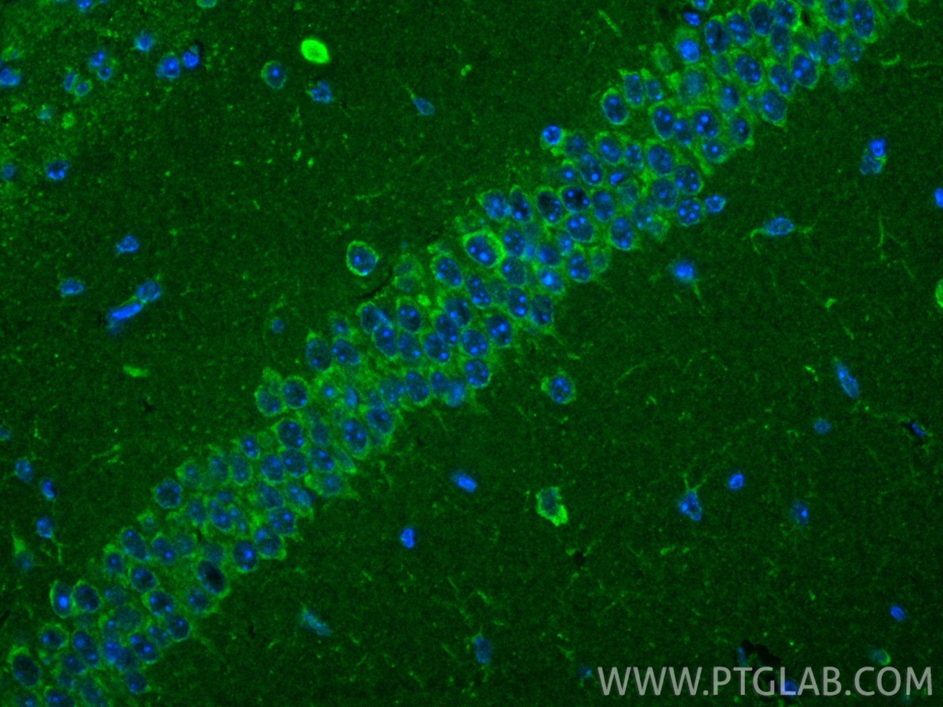 Immunofluorescence (IF) / fluorescent staining of mouse brain tissue using UCP5 Polyclonal antibody (25223-1-AP)