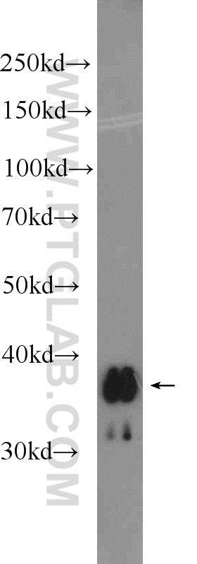 Western Blot (WB) analysis of fetal human brain tissue using UCP5 Polyclonal antibody (25223-1-AP)