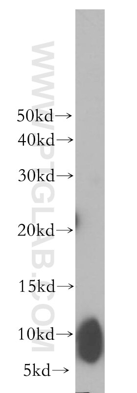 Western Blot (WB) analysis of human liver tissue using UCRC Polyclonal antibody (17779-1-AP)