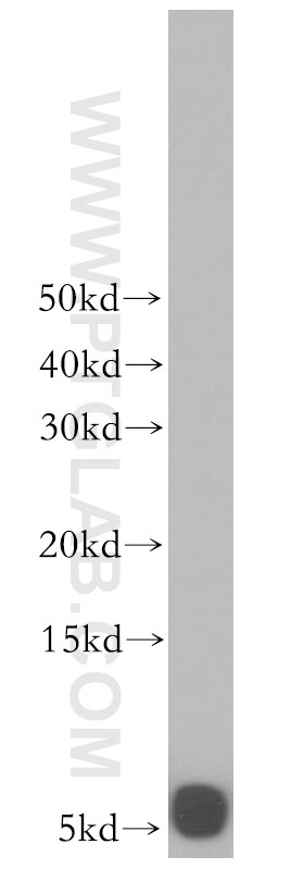 Western Blot (WB) analysis of human heart tissue using UCRC Polyclonal antibody (17779-1-AP)