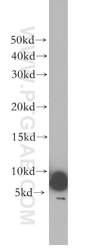 Western Blot (WB) analysis of mouse skeletal muscle tissue using UCRC Polyclonal antibody (17779-1-AP)