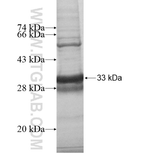 UCRC fusion protein Ag10911 SDS-PAGE