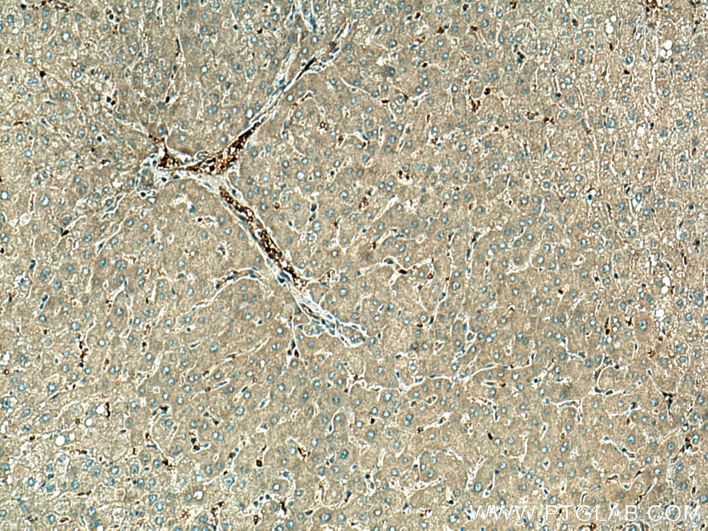 Immunohistochemistry (IHC) staining of human liver tissue using UFC1 Polyclonal antibody (15783-1-AP)