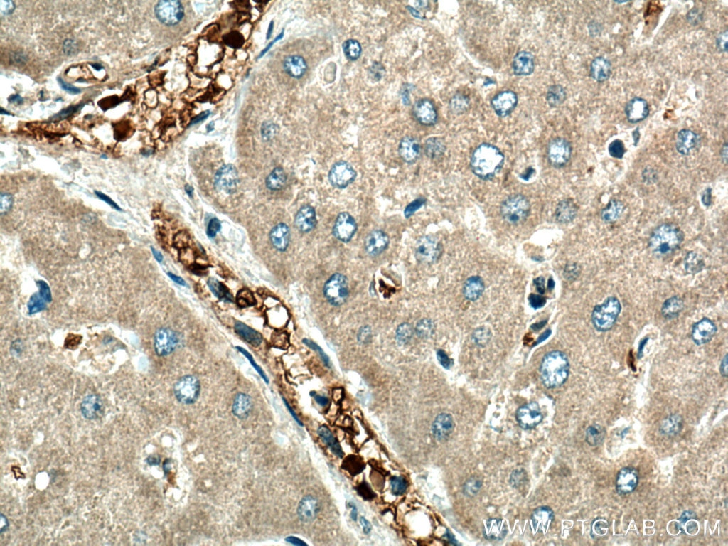 Immunohistochemistry (IHC) staining of human liver tissue using UFC1 Polyclonal antibody (15783-1-AP)