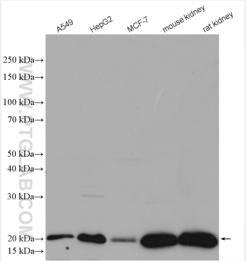 Western Blot (WB) analysis of various lysates using UFC1 Polyclonal antibody (15783-1-AP)