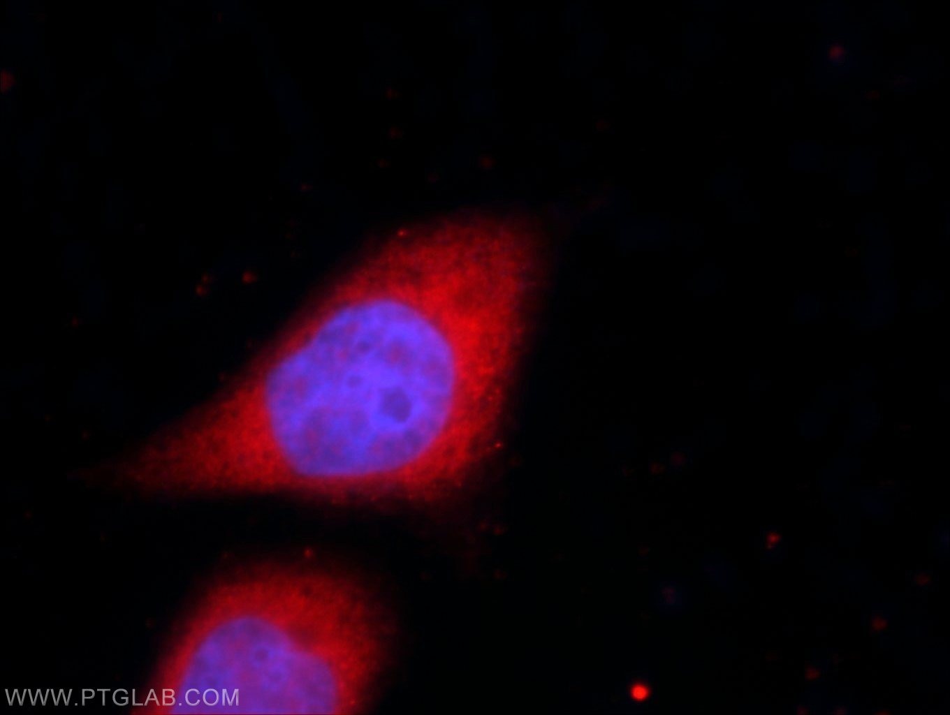 Immunofluorescence (IF) / fluorescent staining of HeLa cells using UFD1L Polyclonal antibody (10615-1-AP)