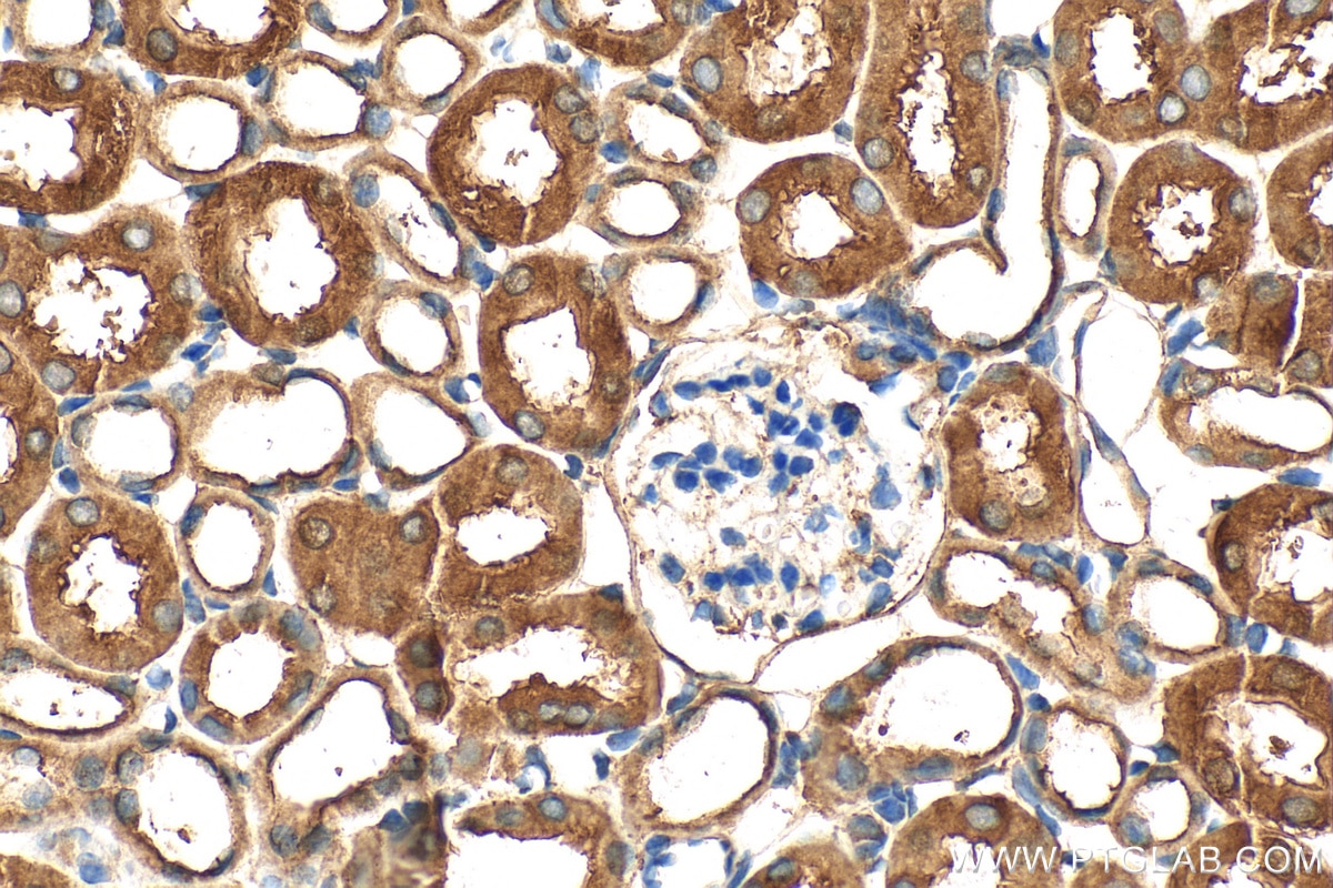 Immunohistochemistry (IHC) staining of mouse kidney tissue using UFD1L Polyclonal antibody (10615-1-AP)
