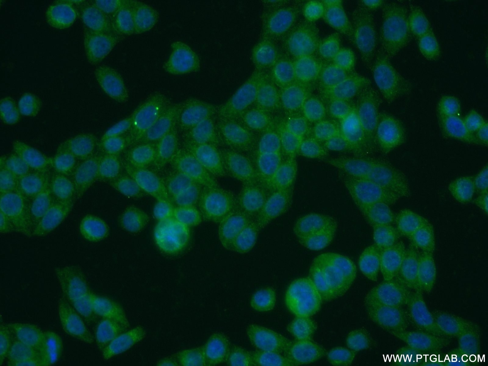 Immunofluorescence (IF) / fluorescent staining of HeLa cells using UFSP2 Polyclonal antibody (16999-1-AP)