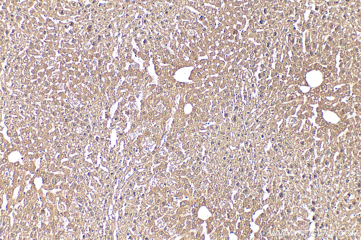 Immunohistochemistry (IHC) staining of mouse liver tissue using UFSP2 Polyclonal antibody (16999-1-AP)