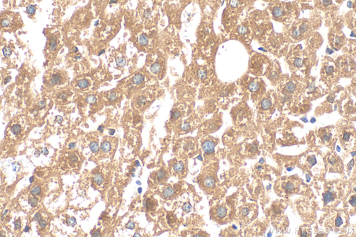 Immunohistochemistry (IHC) staining of mouse liver tissue using UFSP2 Polyclonal antibody (16999-1-AP)
