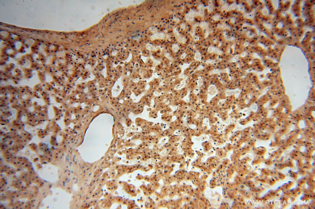 IHC staining of human liver using 16999-1-AP