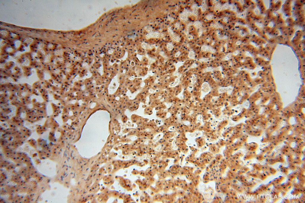 Immunohistochemistry (IHC) staining of human liver tissue using UFSP2 Polyclonal antibody (16999-1-AP)