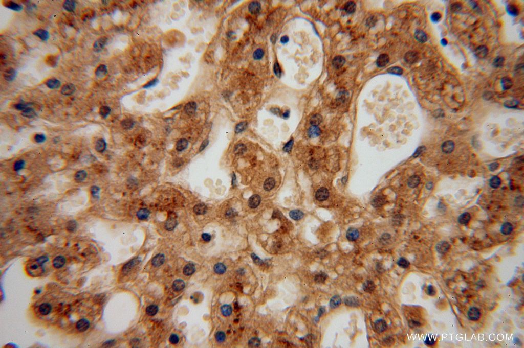 Immunohistochemistry (IHC) staining of human liver tissue using UFSP2 Polyclonal antibody (16999-1-AP)