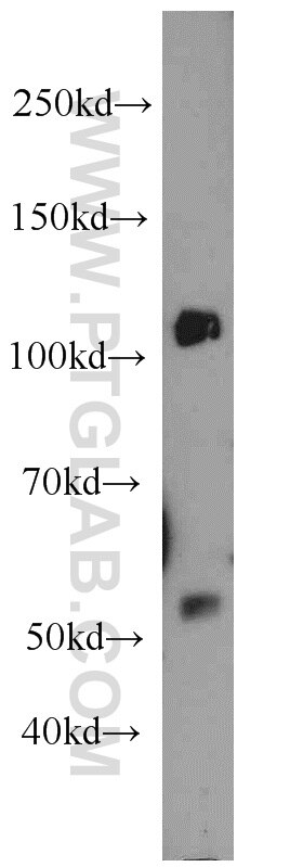 Western Blot (WB) analysis of NIH/3T3 cells using UFSP2 Polyclonal antibody (16999-1-AP)