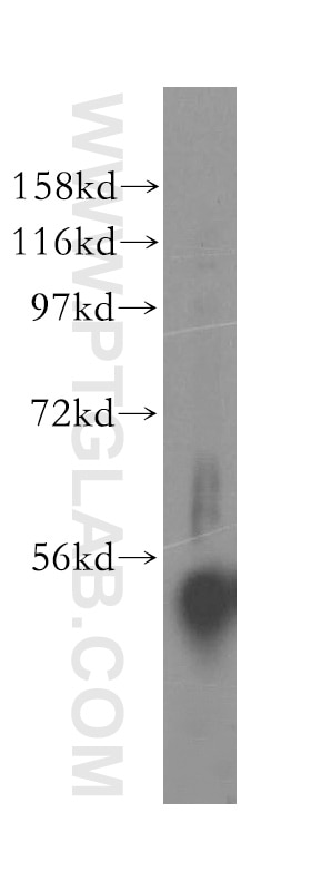 Western Blot (WB) analysis of mouse pancreas tissue using UFSP2 Polyclonal antibody (16999-1-AP)
