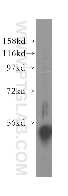 WB analysis of mouse pancreas using 16999-1-AP