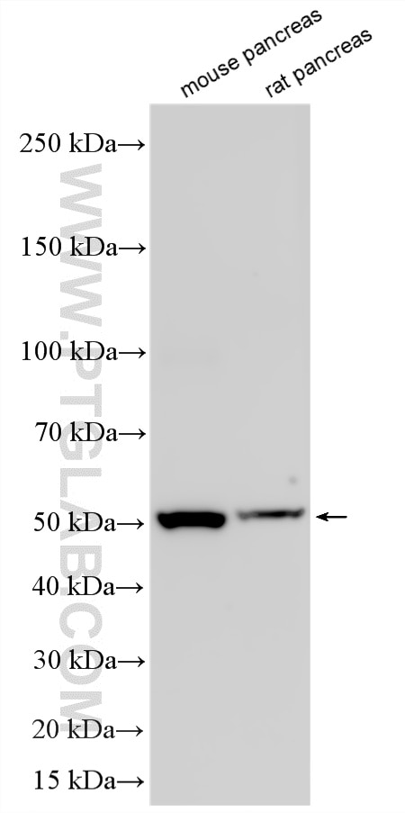 Western Blot (WB) analysis of various lysates using UFSP2 Recombinant monoclonal antibody (86436-1-RR)