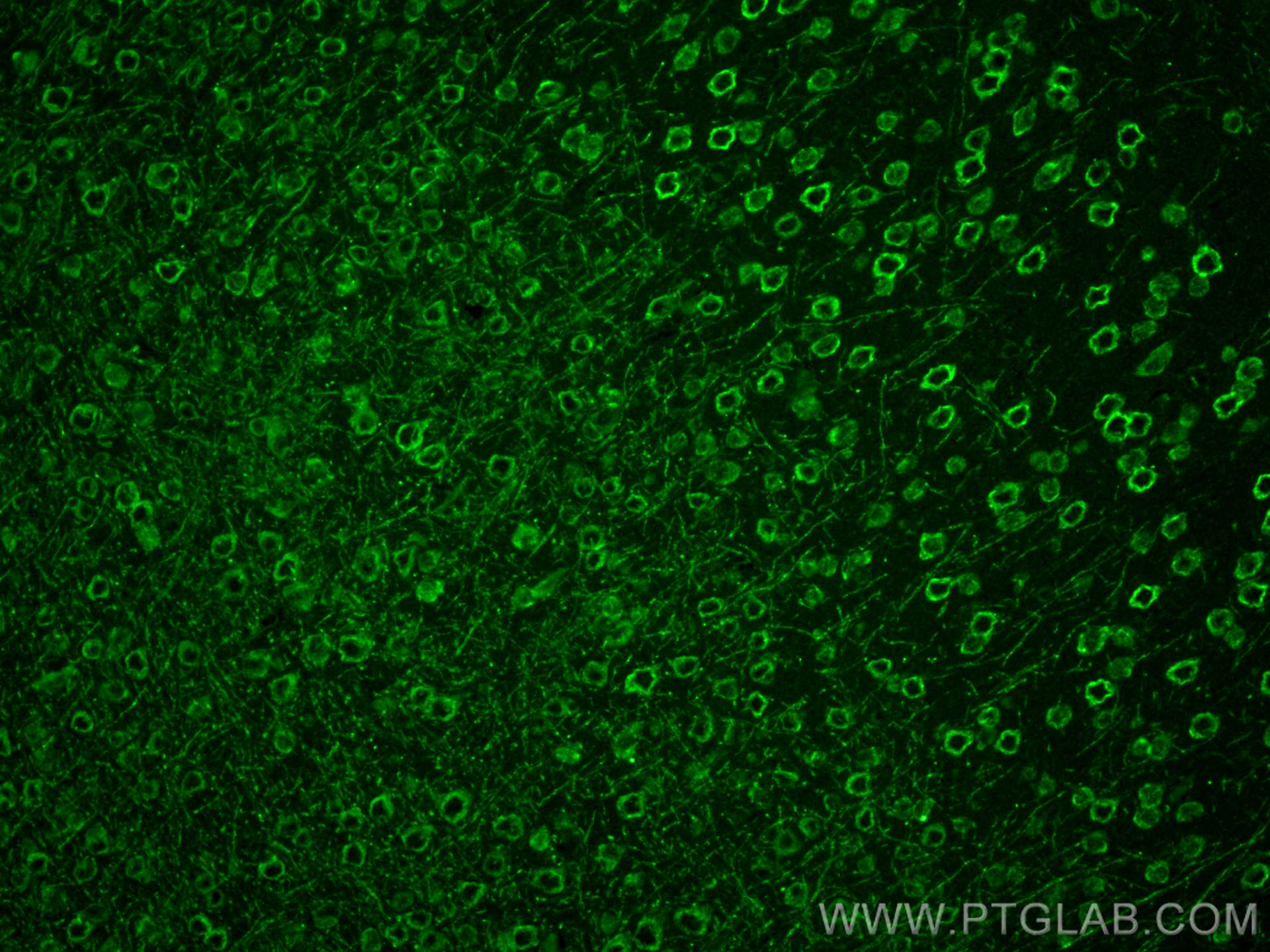 IF Staining of mouse brain using 12869-1-AP