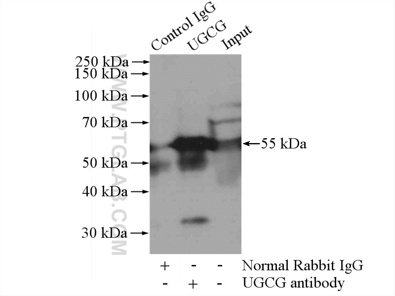 Immunoprecipitation (IP) experiment of A375 cells using UGCG Polyclonal antibody (12869-1-AP)