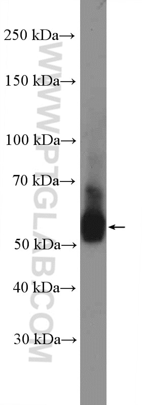 Western Blot (WB) analysis of U-251 cells using UGCG Polyclonal antibody (12869-1-AP)