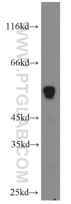 Western Blot (WB) analysis of A375 cells using UGCG Polyclonal antibody (12869-1-AP)