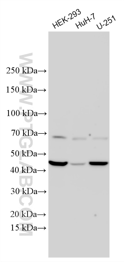 Western Blot (WB) analysis of various lysates using UGCG Polyclonal antibody (33967-1-AP)