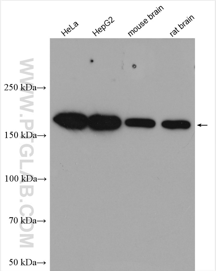 Western Blot (WB) analysis of various lysates using UGCGL1 Polyclonal antibody (14170-1-AP)