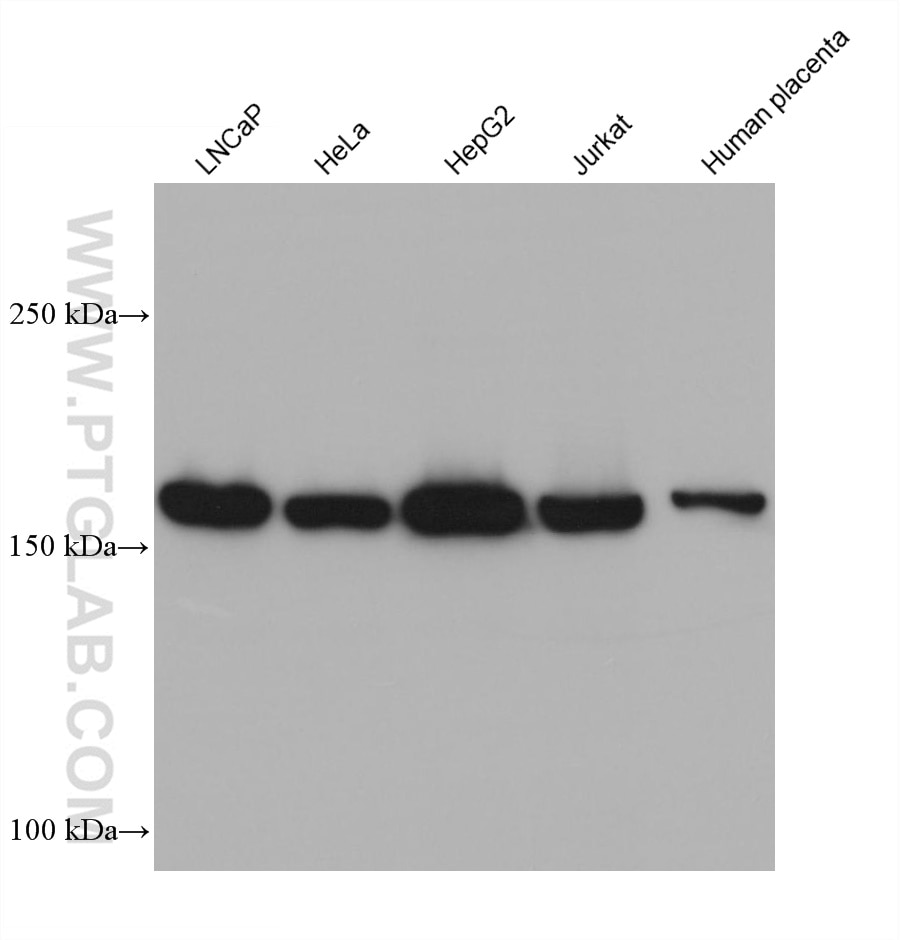 Western Blot (WB) analysis of various lysates using UGCGL1 Monoclonal antibody (68462-1-Ig)