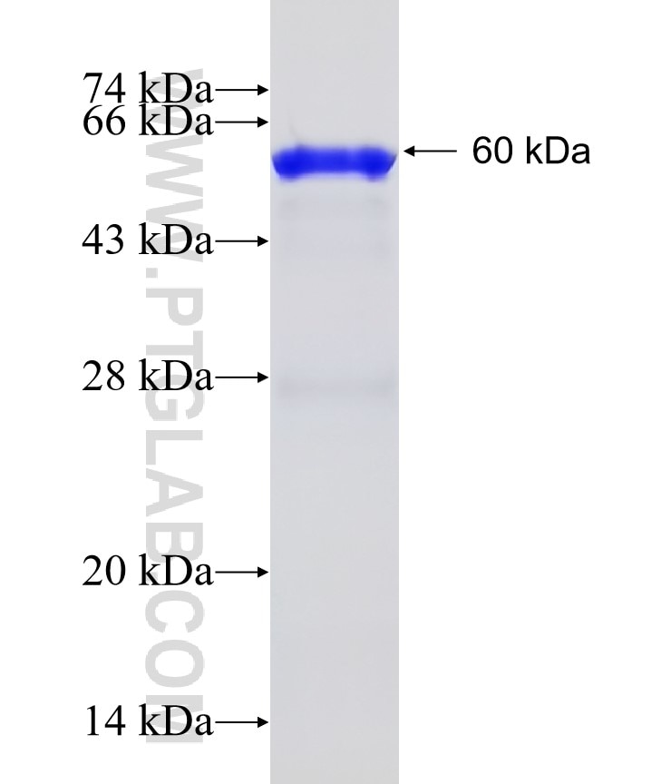 UGCGL1 fusion protein Ag5369 SDS-PAGE