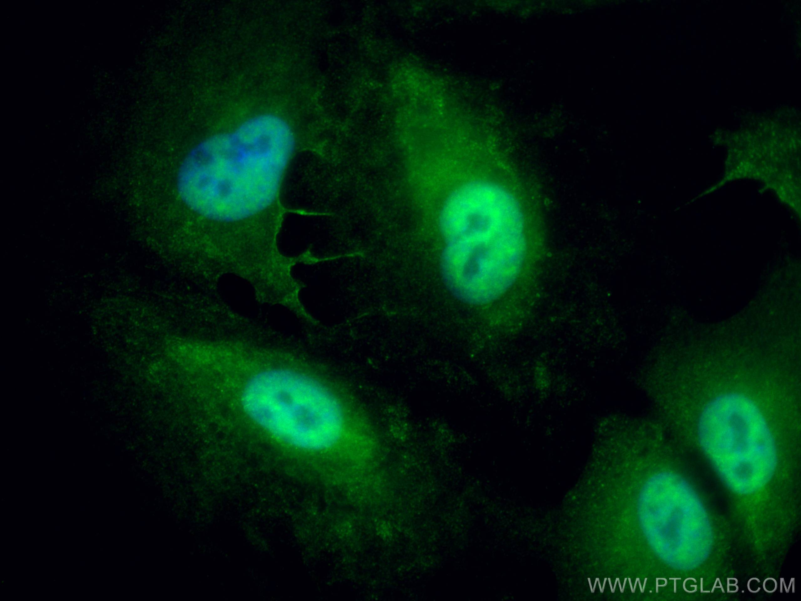 Immunofluorescence (IF) / fluorescent staining of A549 cells using UGDH Polyclonal antibody (13151-1-AP)