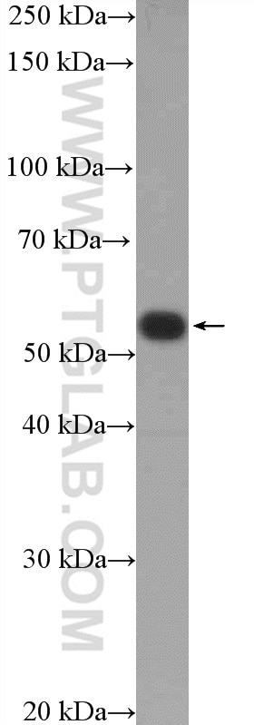 WB analysis of mouse liver using 13151-1-AP