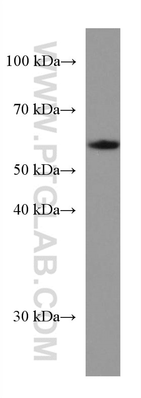 Western Blot (WB) analysis of rat brain tissue using UGDH Monoclonal antibody (67360-1-Ig)