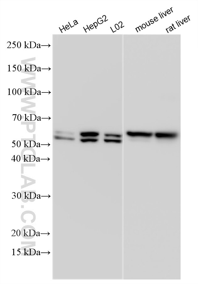 Various lysates were subjected to SDS PAGE followed by western blot with 10391-1-AP (UGP2 antibody) at dilution of 1:15000 incubated at room temperature for 1.5 hours. Western Blot (WB) analysis of various lysates using UGP2 Polyclonal antibody (10391-1-AP)