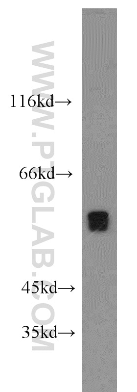 Western Blot (WB) analysis of HeLa cells using UGP2 Polyclonal antibody (10391-1-AP)