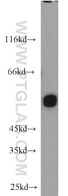 Western Blot (WB) analysis of HepG2 cells using UGP2 Polyclonal antibody (10391-1-AP)