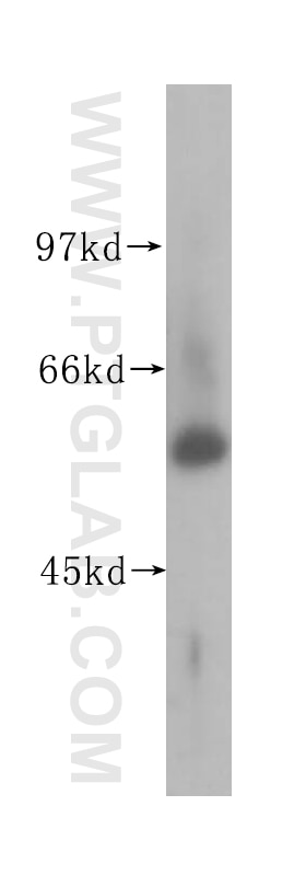 Western Blot (WB) analysis of HEK-293 cells using UGP2 Polyclonal antibody (10391-1-AP)